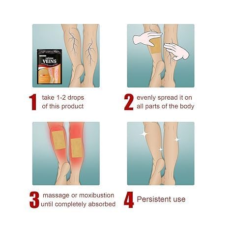 Hanel™ Varicose Veins Relief Patches - Reduces Swelling, Relieves Pain, Improves Blood Circulation & Vein Health | Herbal, Skin-Friendly & Instant Pain Relief (Pack of 12)