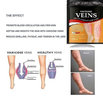 Hanel™ Varicose Veins Relief Patches - Reduces Swelling, Relieves Pain, Improves Blood Circulation & Vein Health | Herbal, Skin-Friendly & Instant Pain Relief (Pack of 12)