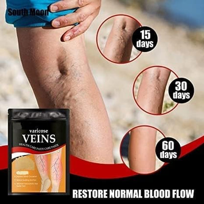 Hanel™ Varicose Veins Relief Patches - Reduces Swelling, Relieves Pain, Improves Blood Circulation & Vein Health | Herbal, Skin-Friendly & Instant Pain Relief (Pack of 12)